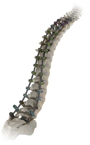 spinal cord injury, spinal cord injury recovery, what is a spinal cord injury, spinal anatomy