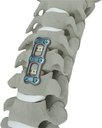 spinal cord injury, spinal cord injury recovery, what is a spinal cord injury, spinal anatomy