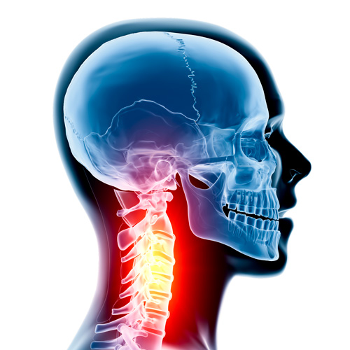 spinal cord injury